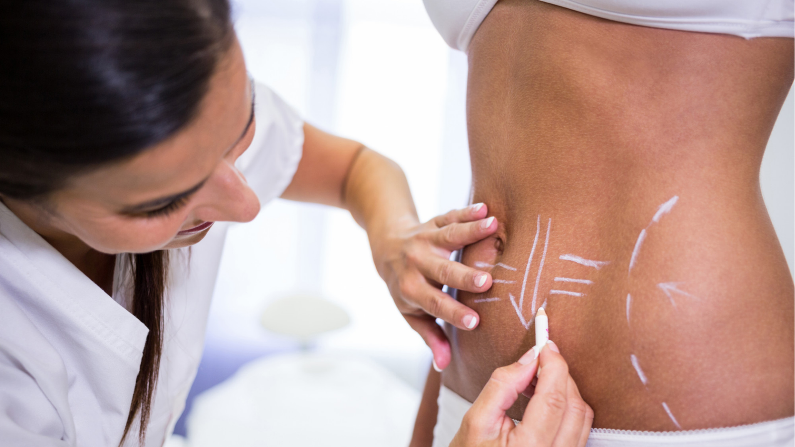 Lipoaspiração, abdominoplastia ou lipo HD | Dr. Victor Rezende